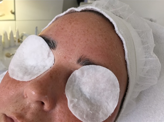 behandeling mooi bij bar